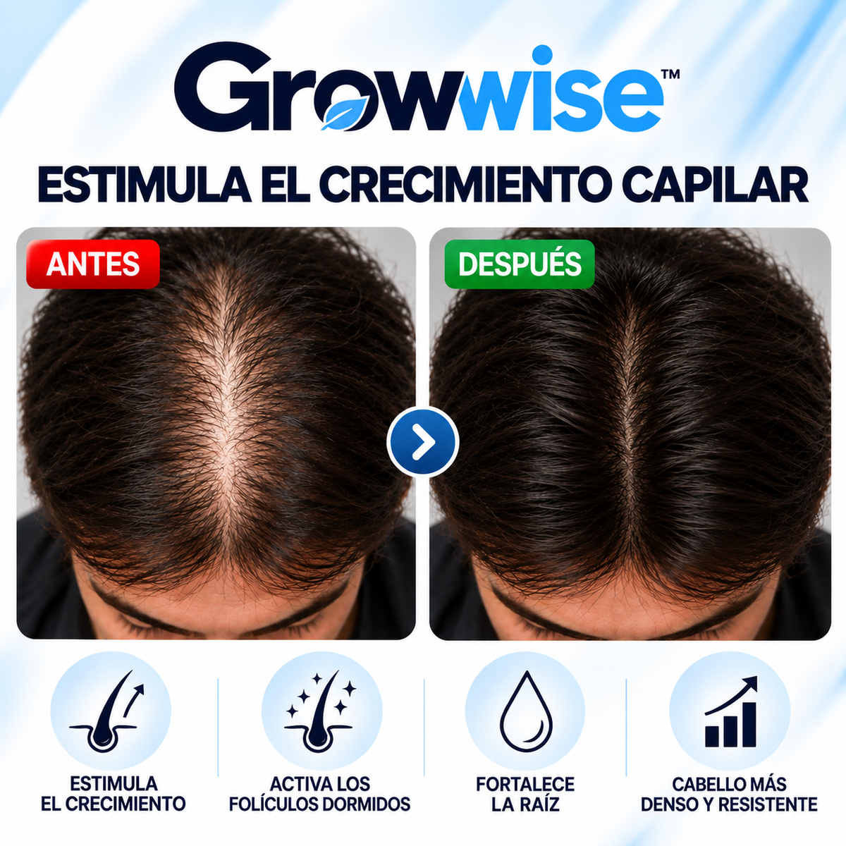 Growwise™ Bodywise Roll-On — Sérum Tópico para Crecimiento de Cabello, Barba y Cejas | Romero 3%